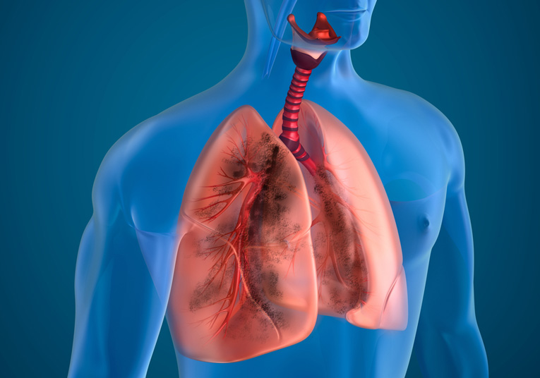 Chest Conditions